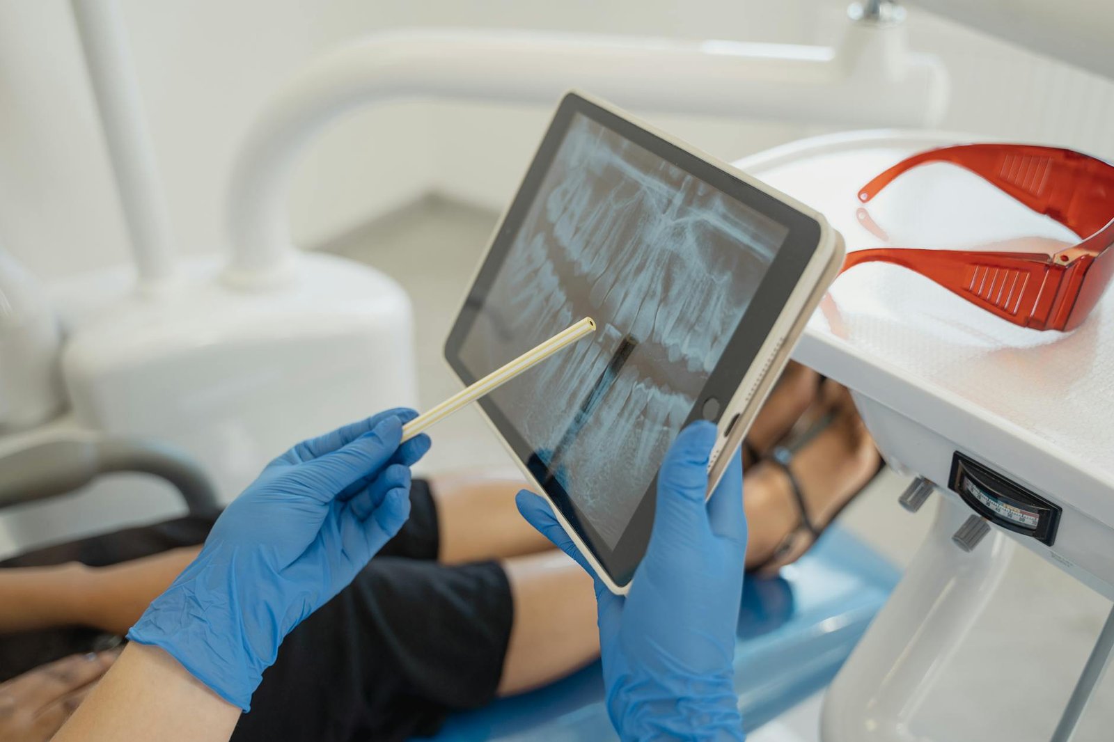 Illustration of Root Canal Pain Jaipur: Must-Have FAQ for Effortless RCT at EnamelD Clinic